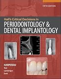 Halls Critical Decisions In Periodontology