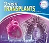 Organ Transplants (Essential Library of Medical Marvels)