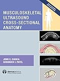 Musculoskeletal Ultrasound Crosssectional Anatomy