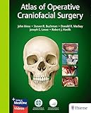 Atlas Of Operative Craniofacial Surgery