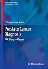 Prostate Cancer Diagnosis PSA, Biopsy and Beyond