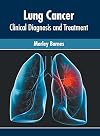 Lung Cancer: Clinical Diagnosis and Treatment