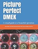 Picture Perfect Dmek A Visual Guide To A Beautiful Operation