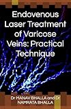 Endovenous Laser Treatment Of Varicose Veins Practical Technique
