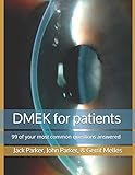 Dmek For Patients 99 Of Your Most Common Questions Answered