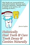 Holistically Heal Teeth Cure Tooth Decay Cavities Naturally The Book On Conventional And Alternative Dental Care Healing Cavities Toothaches Other Oral Pains Oil Pulling More