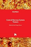 Central Nervous System Tumors/ [ Edited by] Scott George Turner.