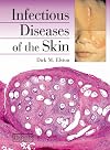 Infectious Diseases of the Skin