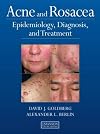 Acne and rosacea epidemiology, diagnosis and treatment