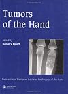 Tumors of the Hand: Published in association with the Federation of European Societies for Surgery of the Hand