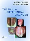 Nail in Differential Diagnosis
