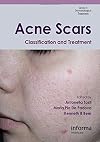 Acne Scars: Classification and Treatment, Second Edition (Series in Dermatological Treatment)