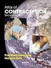Atlas of Contraception: Family Planning & Reproductive Health, Second Edition (ENCYCLOPEDIA OF VISUAL MEDICINE SERIES)