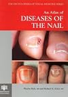 An Atlas of Diseases of the Nail (Encyclopedia of Visual Medicine Series)