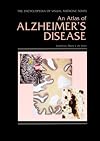 An atlas of Alzheimer's disease