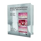Bone Augmentation In Oral Implantology