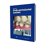 Endoperiodontal Lesions