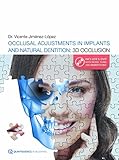 OCCLUSAL ADJUSTMENT IN IMPLANTS AND NATURAL DENTITION: 3D OCCLUSION