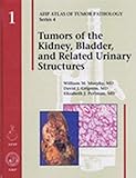 Tumors Of The Kidney Bladder And Related Urinary Structures 2004 Afip Atlas Of Tumor Pathology 4th Series