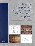 Orthodontic Management Of The Dentition With The Preadjusted Appliance