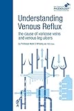 Understanding Venous Reflux The Cause Of Varicose Veins And Venous Leg Ulcers