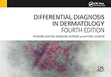 Differential Diagnosis In Dermatology