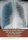 The Unofficial Guide to Radiology: 100 Practice Chest X Rays with Full Colour Annotations and Full X Ray Reports (Unoffical Guides)