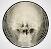 Bone Music: Soviet X-Ray Audio