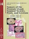 Tumors of the Prostate Gland, Seminal Vesicles, Penis, and Scrotum: 14 (AFIP Atlas of Tumor Pathology: Series 4)