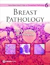 Breast Pathology (Consultant Pathology, Volume 6)