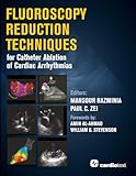 Fluoroscopy Reduction Techniques For Catheter Ablation Of Cardiac Arrhythmias