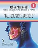 Johan P Reynekes Techniques Tips Tricks And Traps Volume 1 The Bilateral Sagittal Split Mandibular Ramus Osteotomy
