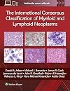 The International Consensus Classification of Myeloid and Lymphoid Neoplasms