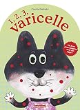 1 2 3 Varicelle