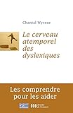 Cerveau Atemporel Des Dyslexiques Les Comprendre Et Les Aider