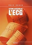 Lecture accélérée de l'ECG