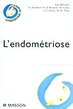 Lendomtriose