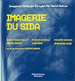Imagerie Du Sida