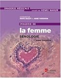Imagerie De La Femme Snologie