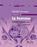 Imagerie De La Femme Gyncologie Tome 2