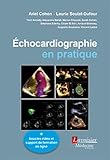 Echocardiographie En Pratique