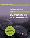 Imagerie Du Foetus Au Nouveaun