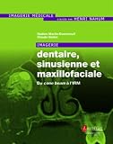 Imagerie Dentaire Sinusienne Et Maxillofaciale Du Cone Beam Lirm