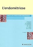 Lendomtriose