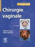 Chirurgie Vaginale