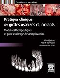 Pratique Clinique Des Greffes Osseuses Et Implants Modalits Thrapeutiques Et Prise En Charge Des Complications