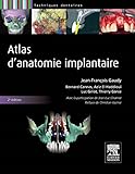 Atlas D'anatomie Implantaire: Pilon Partiel 400ex 19