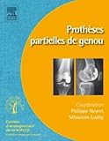 Prothses Partielles De Genou