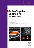Echo Doppler Vasculaire Et Visc%C3%A9ral