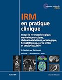 Irm En Pratique Clinique Imagerie Neuroradiologique Musculosquelettique Abdominopelvienne Oncologique Hmatologique Corp